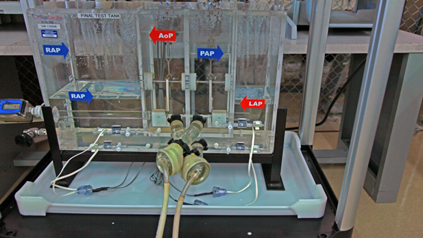 artificial-heart_spotlight