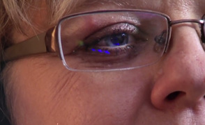 Sara Palmer eye EMDR