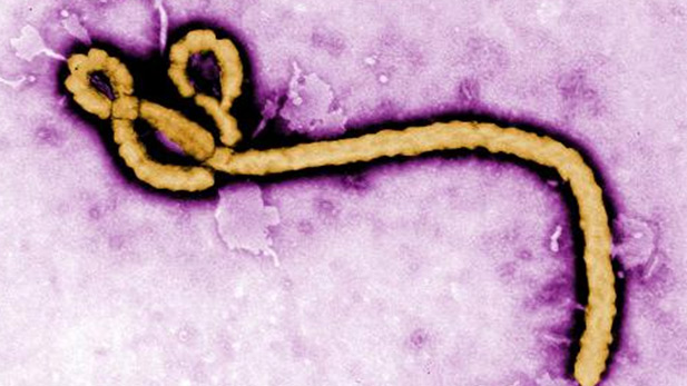 Ebola virus.