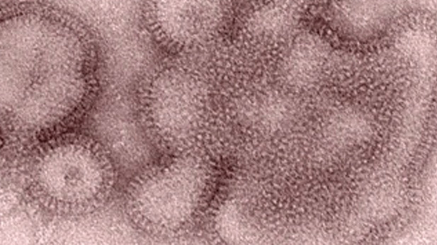 influenza virus spot 1