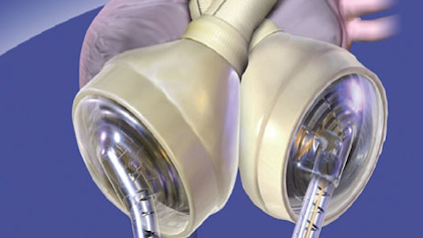 SynCardia artificial heart