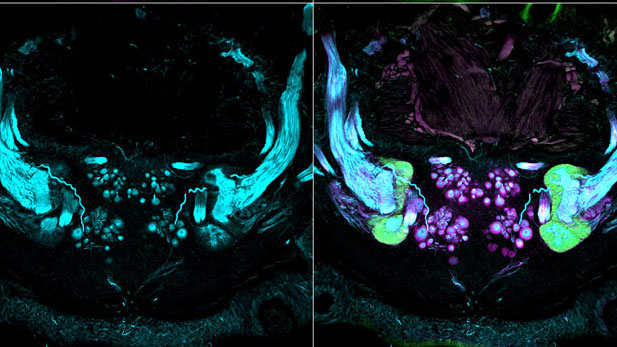 Cross section of nerve bundles entering the brain of a sand worm (Nereis virens), stained with fluorescent dyes (three colors merged on right).