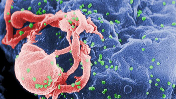 Scanning electron micrograph of HIV-1 virions budding from a cultured lymphocyte. 
