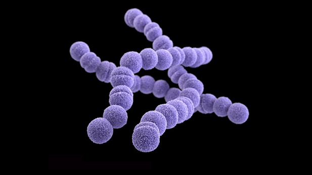 The bacteria, called Group A Strep, typically causes strep throat.