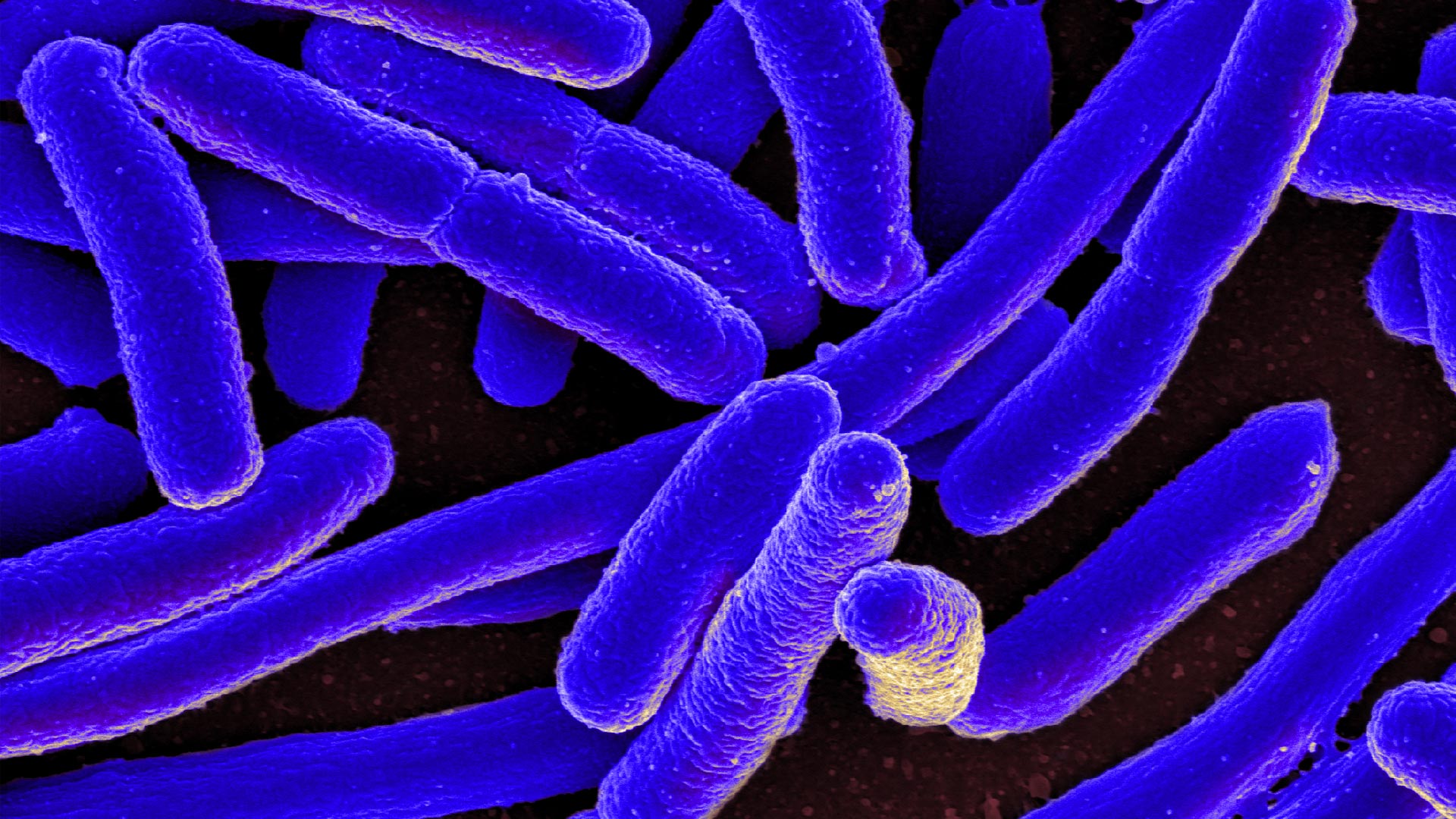 Colorized scanning electron micrograph of Escherichia coli, grown in culture and adhered to a cover slip.