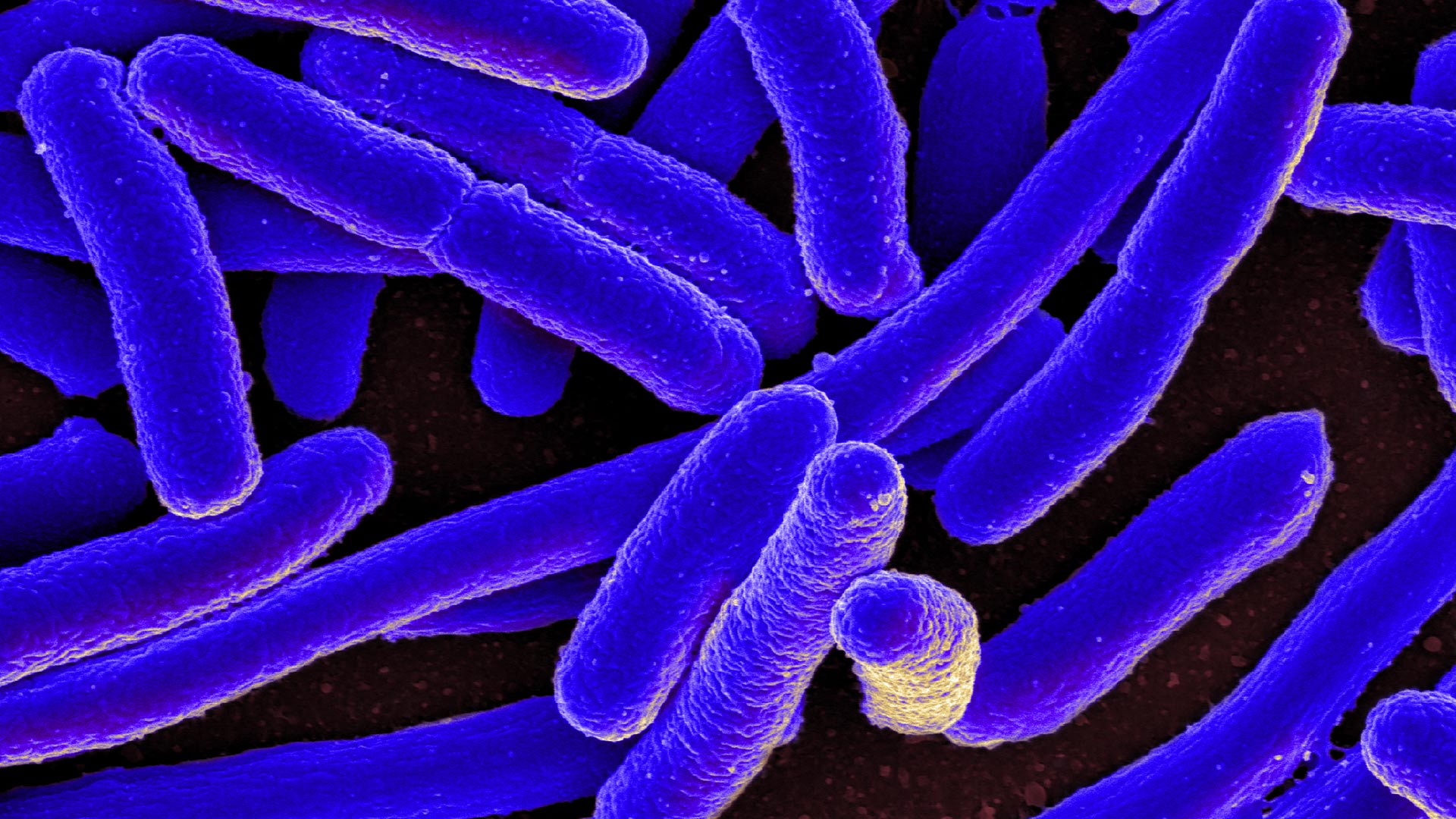 nova_whats_inside_e-coli_hero