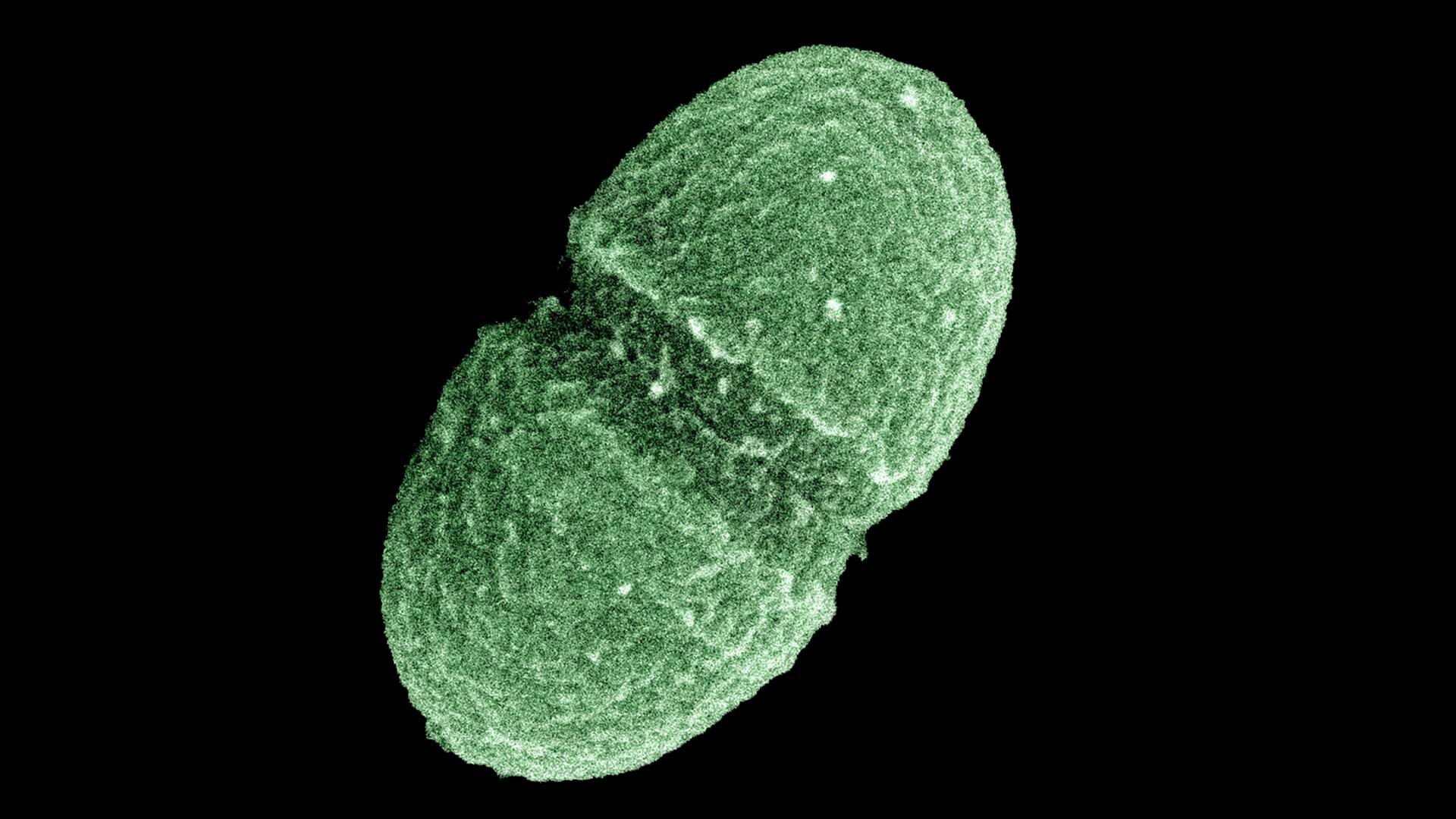 Enterococcus faecalis is just one type of microbe that lives in the human gut.