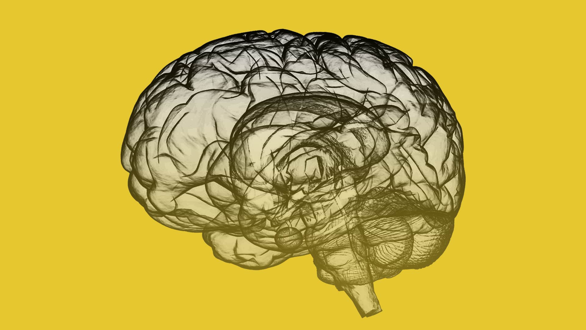 alzheimer's dementia brain scan
