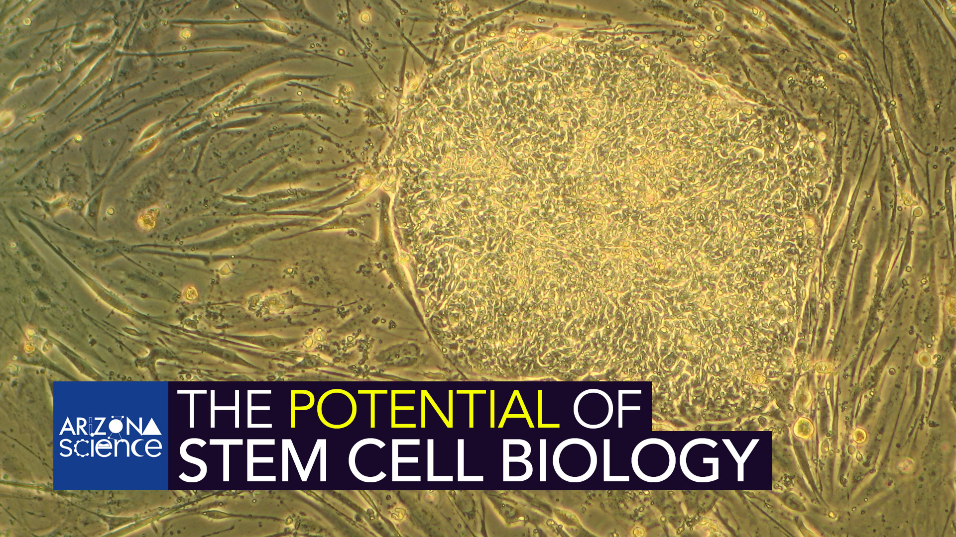AZSCI 181 Stem Cell