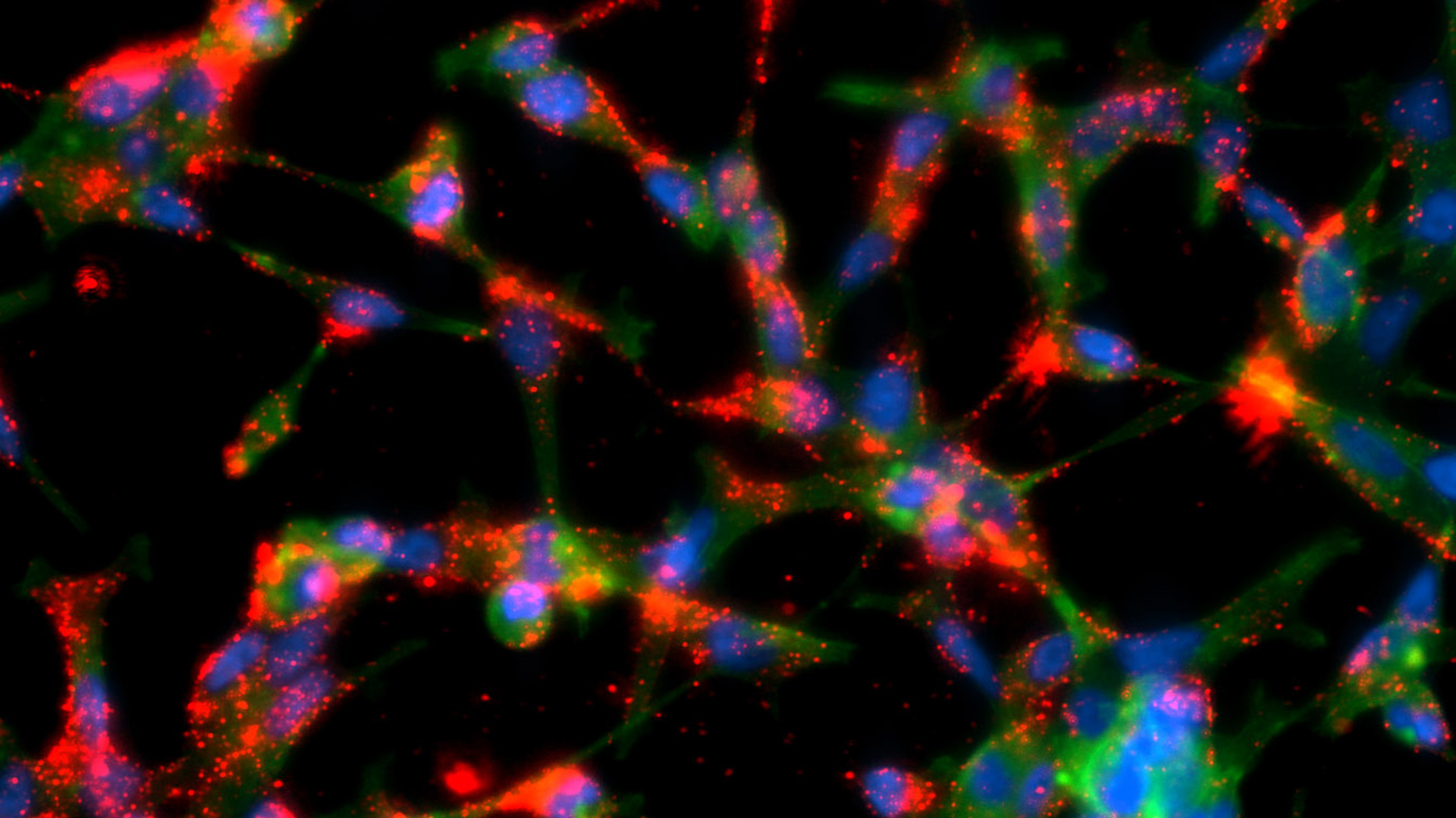 This image shows prostate cancer cells interacting with medicine-carrying nanoparticles. The end goal is to deliver drugs specifically to the tumor. 
