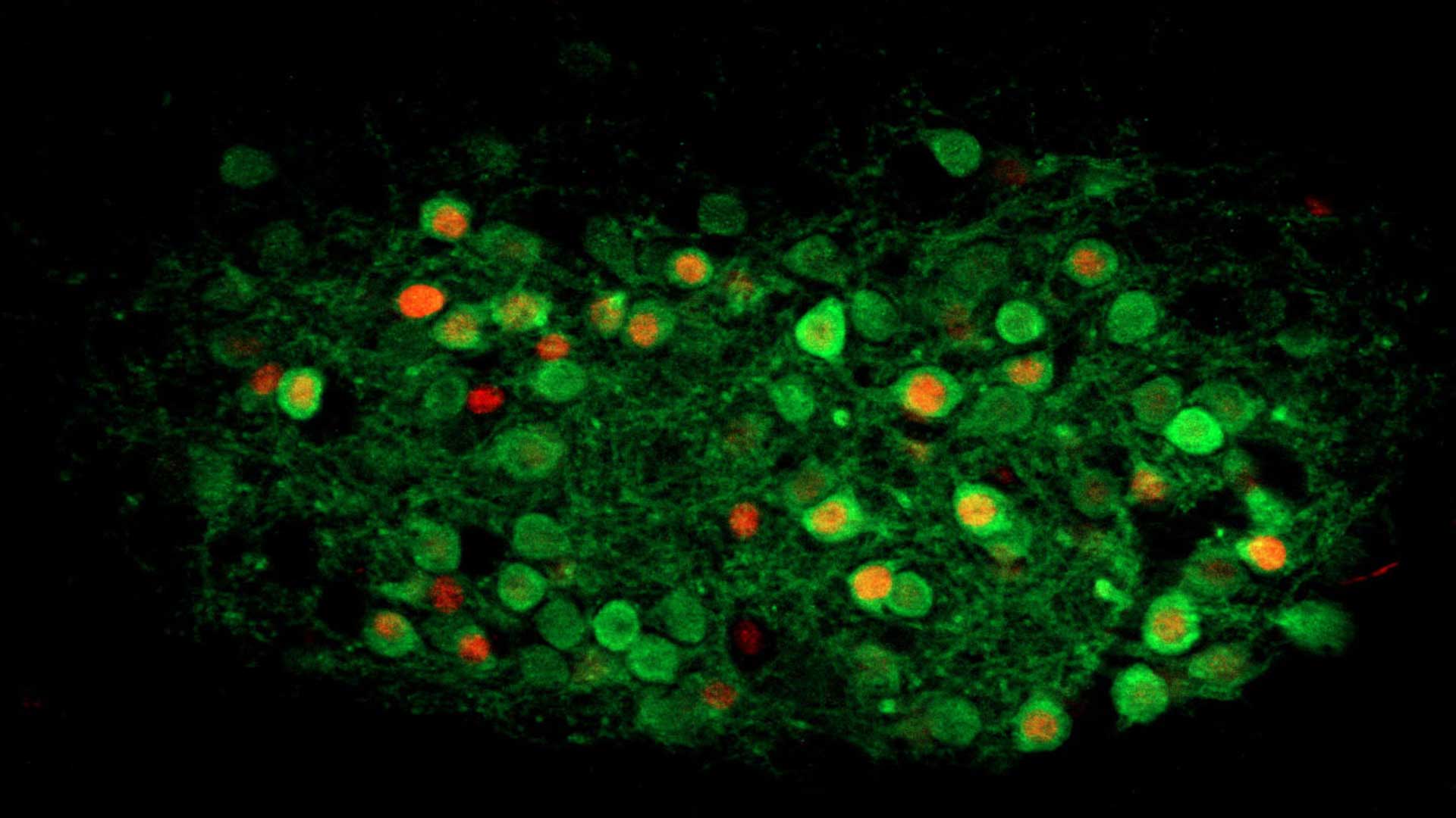 PKC-delta neurons (green) are activated by the inflammatory signal in the oval region of the bed nucleus of stria terminalis (ovBNST). Activated cells are shown in red.