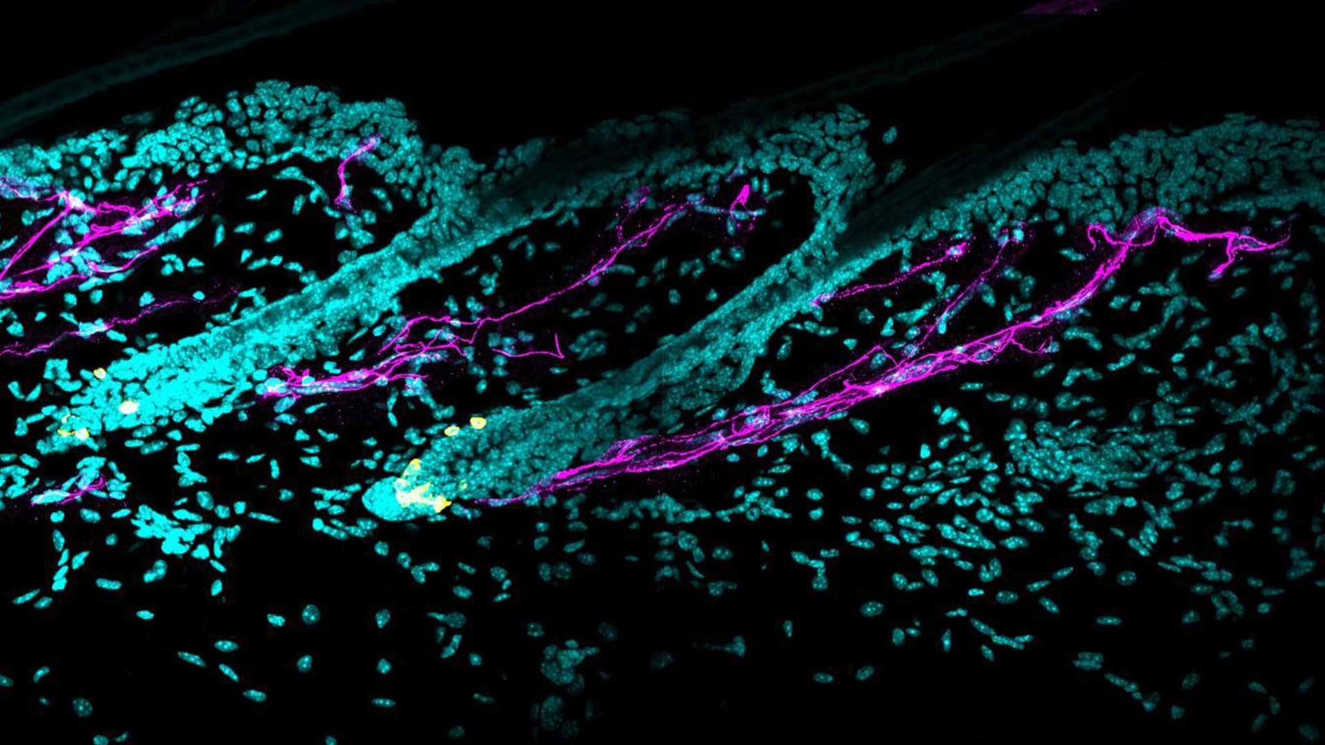 Elaborate sympathetic innervation (magenta) around melanocyte stem cells (yellow). Acute stress induces the sympathetic nervous system to release large amounts of norepinephrine, which drives rapid depletion of melanocyte stem cells and hair graying.