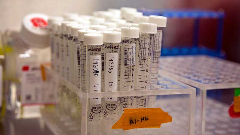 Arizona has its first COVID-19 test that uses saliva. More than 6,000 people have already been tested using the test, ASU scientists say.