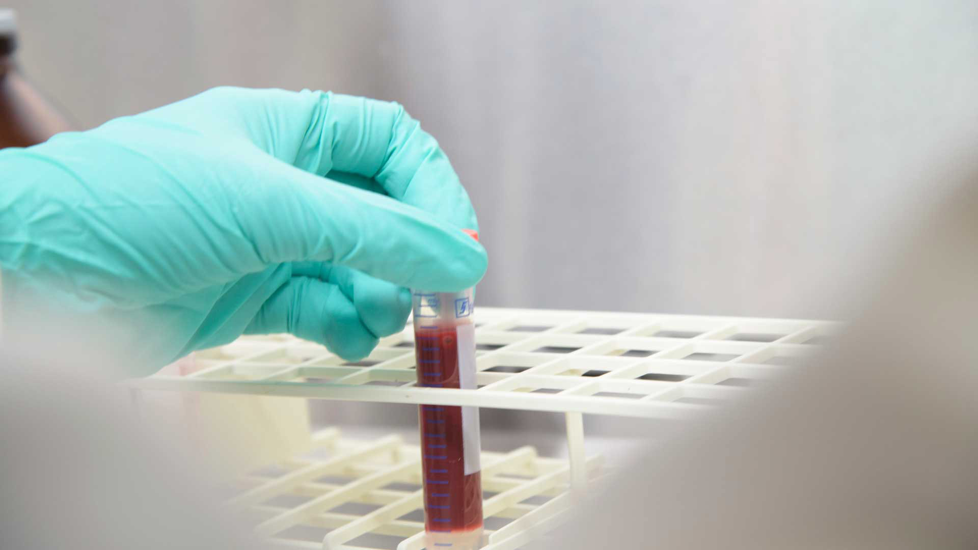 UA antibody testing, June 2020