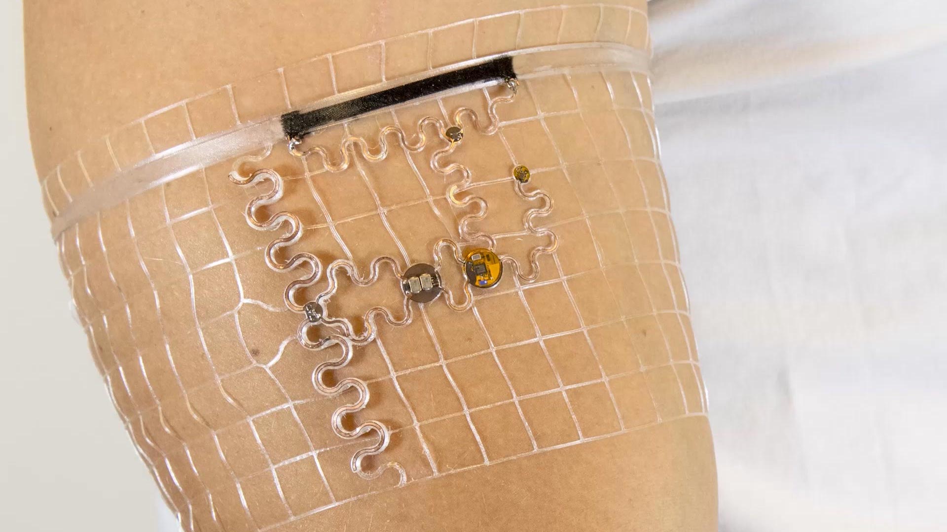 Tiny sensors are embedded in a fitting mesh structure worn like a sleeve.