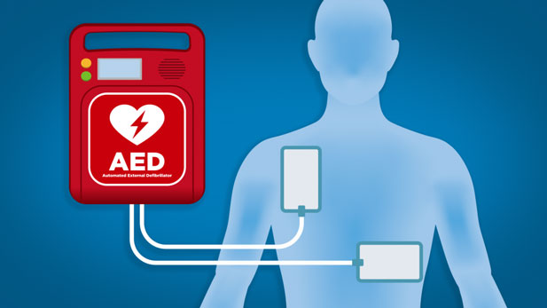 An AED is a type of computerized defibrillator that automatically analyzes the heart rhythm in people who are experiencing cardiac arrest. 