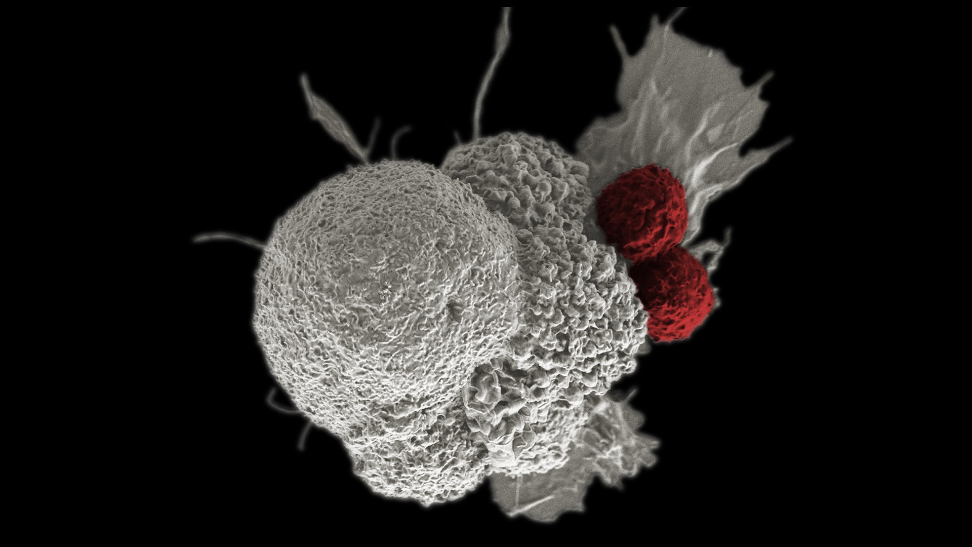 A cancer cell (white) is attacked by two T cells (red) in this electron micrograph image.