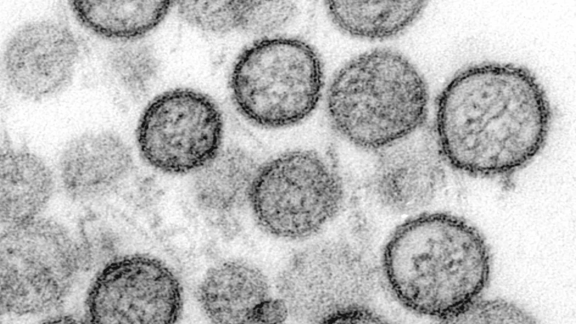 Transmission electron microscopic image of spherical Sin Nombre virus particles, a species of hantavirus.