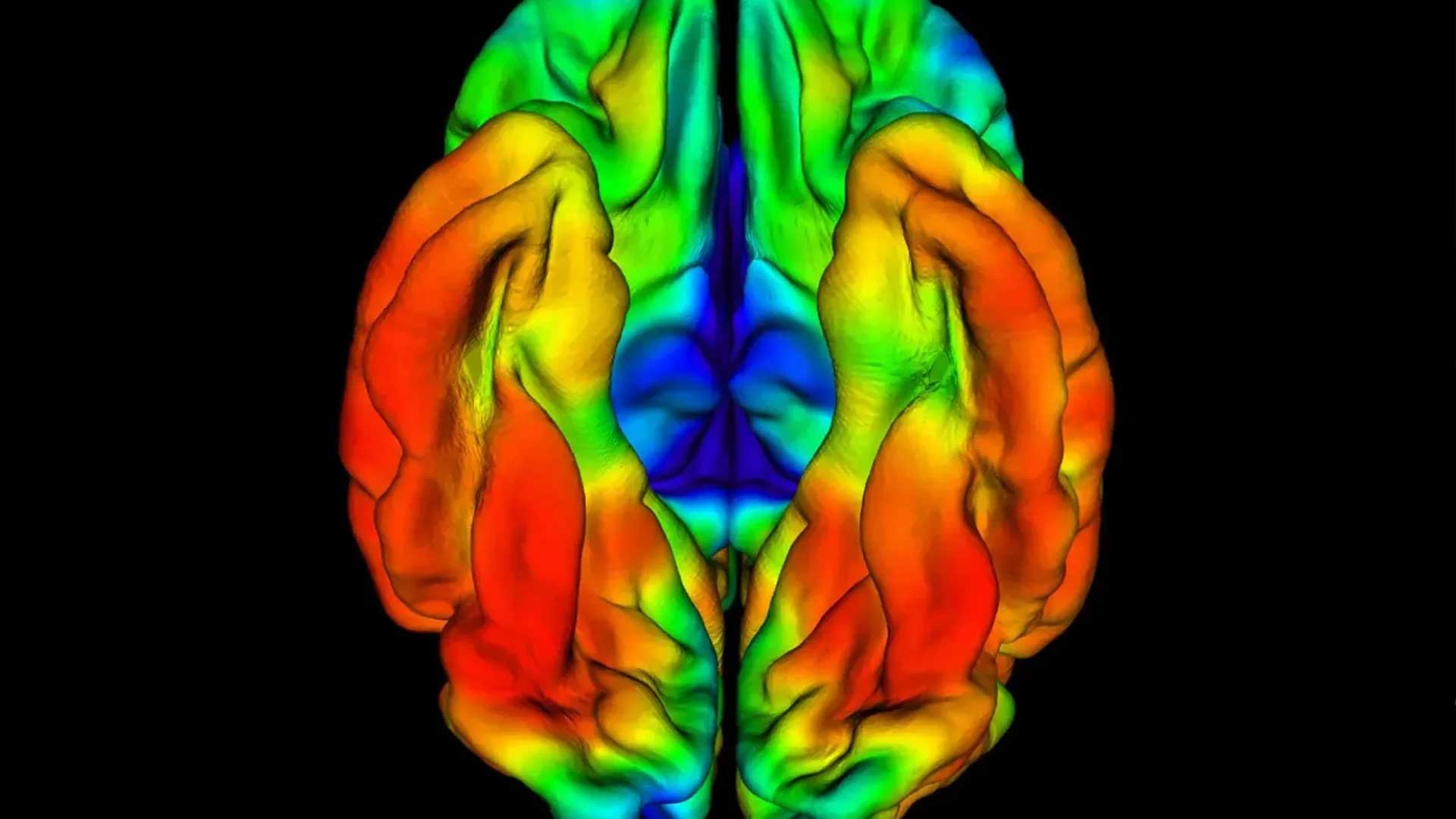 This PET image shows the brain of a Colombian man whose memory and thinking remained intact in his late 60s, even though he carried a rare gene variant that nearly always causes Alzheimer's in a person's 40s.