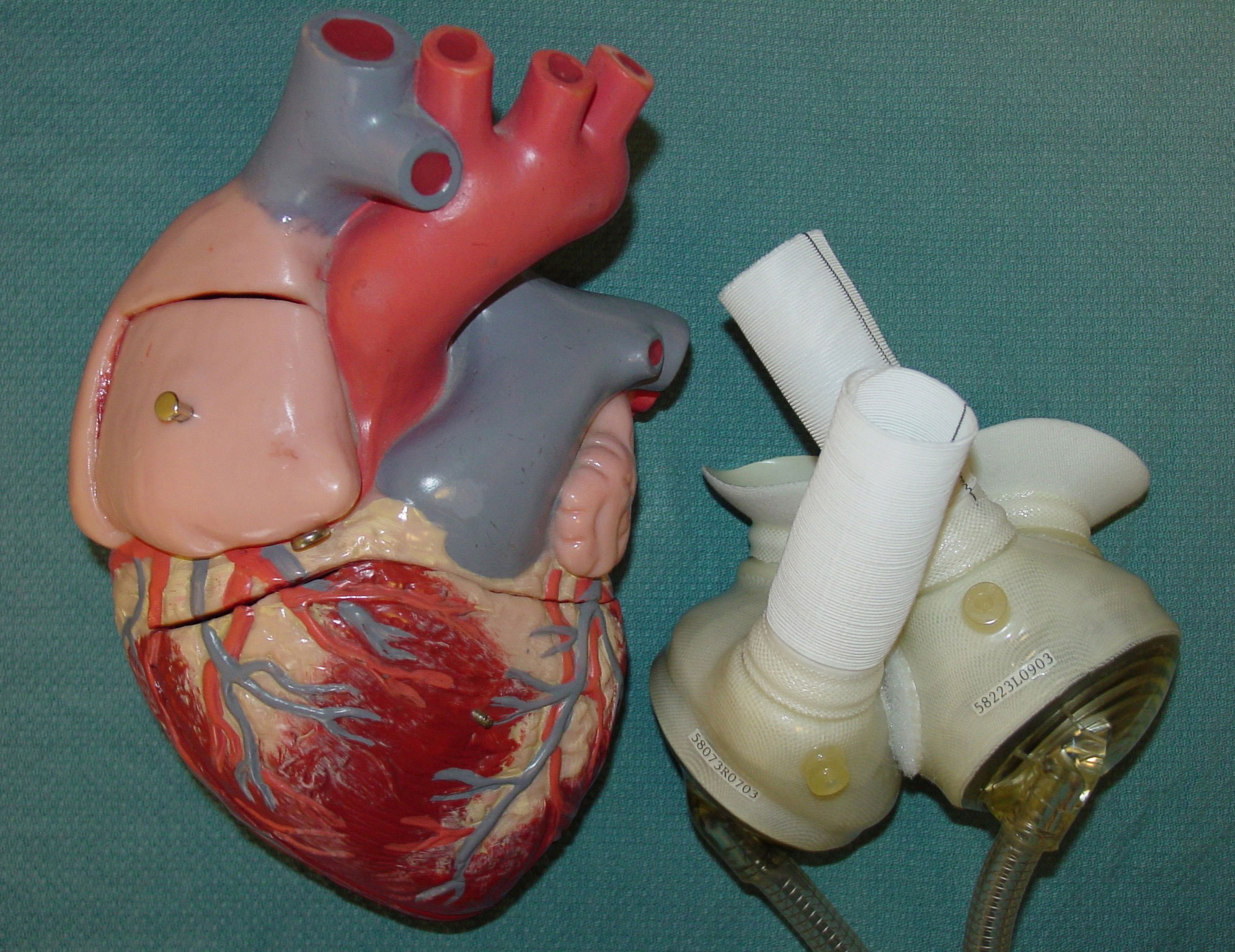 total-artificial heart